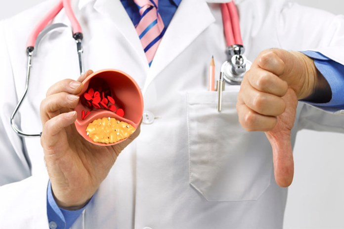 cholesterolis.jpg